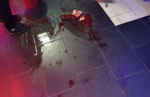 Ochroniarz w klubie uderzył klientem o mur