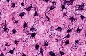 Komórki glejowe - czyli co siedzi w naszym mózgu oprócz neuronów