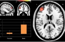 Neuronalne korelaty oszukiwania u kobiet i mężczyzn