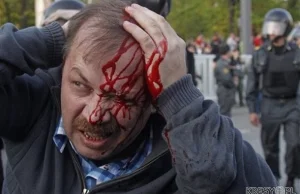 Protesty w Rosji. Galeria zdjęć (uwaga: drastyczne!)