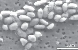 Bakterie na arsenie? Nowe badania podważają ich istnienie