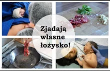 Zjadły swoje łożysko, aby uniknąć depresji!