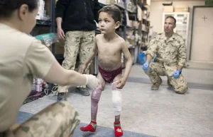 Polscy lekarze pomogli afgańskiemu chłopcu