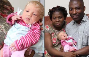 Genetyczna niespodzianka: Czarnoskórej parze urodziło się białe dziecko