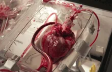 'Serce w pudełku' - utrzymuje bicie serca aż do transplantacji [ENG]