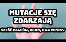 Mutacje się zdarzają. Sześć palców, ogon, dwa penisy... - [Ciekawa Sprawa]