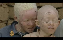 Afrykańscy albinosi zabijani dla organów "przynoszących szczęście"