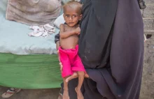 JEMEN: 85 tys. dzieci zabitych w wojnie prowadzonej przez Arabię Saudyjską