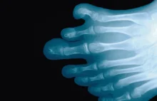 Dodatkowe palce, podwójna macica. 7 osobliwości ludzkiej anatomii
