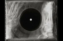 [ENG] Bone Music - vinyle na starych zdjęciach rentgenowskich