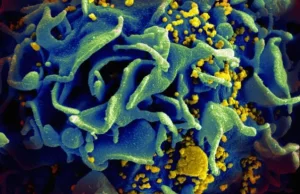 Naukowcy zidentyfikowali miejsce pochodzenia epidemii AIDS [ENG]