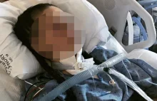 13-latka osłoniła ciałem niemowlę. Jest w ciężkim stanie