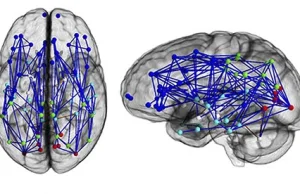Badania dowiodły różnic w budowie mózgu kobiety i mężczyzny[ENG]