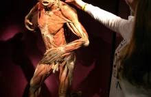 The Human Body: prokurator ma oko na wystawę ludzkich ciał