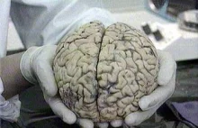 Odkryto połączenie układu odpornościowego z mózgiem