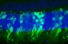 Przeszczepione fotoreceptory przywróciły myszom wzrok