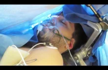 Amerykański vloger nagrał swoją operację mózgu