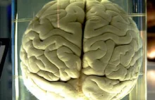 Szkoccy naukowcy hodują szalone mózgi ze skóry