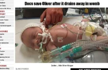 Ten chłopczyk urodził się bez krwi w żyłach. Lekarze cudem go ocalili