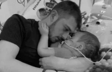 Alfie Evans nie żyje