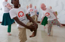 Tanzania: bycie albinosem jest śmiertelnie niebezpieczne