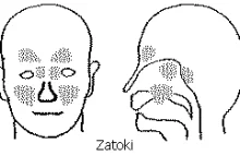 Jak poradzić sobie z zatokami? Jala neti - skuteczne czyszczenie zatok