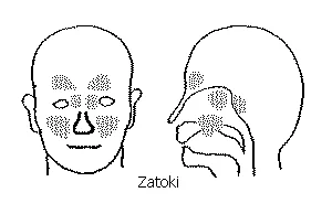 Jak poradzić sobie z zatokami? Jala neti - skuteczne czyszczenie zatok