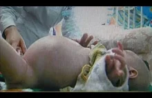 Chłopiec który urodził brata bliźniaka - film dokumentalny
