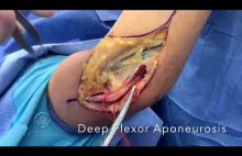 Zabieg uwolnienia (dekompresji) nerwu łokciowego. Anatomy and Surgery