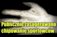 Światowe Stowarzyszenie Olimpijczyków zasugerowało czipowanie sportowców!