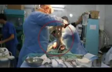 Lekarze ratuja dziecko po bombardowaniu w Syrii