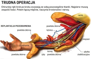 Przeszczep ręki, czyli setki niewidocznych nici