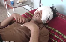 PAKISTAN: Ojciec wydłubał swojemu 22-letniemu synowi oczy za pomocą łyżeczki.