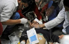 Syria Wiele ofiar ataku chemicznego Wstrząsające nagrania z Ghuty