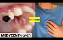 Próchnica zębów = większe ryzyko chorób serca i cukrzycy