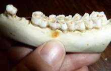 Stomatologia przyszłości oparta będzie na regeneracji zębów-HUMAN_2.0