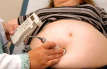 "Ciąża niszczy etaty" Pracodawcy oskarżają lekarzy