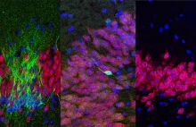 Narodziny nowych neuronów w Hipocampie kończą się w dzieciństwie - nowe odkrycie
