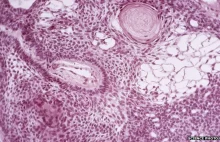Naukowcy z Uniwersytetu Harward stworzyli komórki walczące z rakiem.