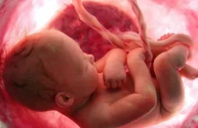 To jest możliwe! Aborcja eugeniczna może być zakazana nawet bez zakazu sejmu.