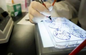 Odkryto cząsteczki blokujące białko sprzyjające powstaniu nowotworu