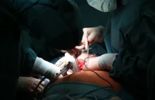 Proces o medyczny błąd. Chusty chirurgiczne zaszyte w brzuchu pacjenta.