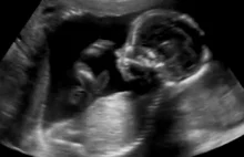 „Aborcja dla każdego” - NHS reklamuje usuwanie ciąży wśród Polek