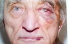Kanada: 74-letni Polak pobity w mieszkaniu spędził 75 dni w areszcie.