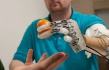 Najbardziej zaawansowana bioniczna ręka na świecie!