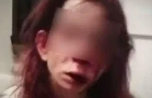 Niepełnosprawna australijka, porwana i torturowana przez dziewczęcy gang