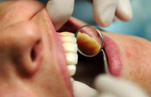 Wysokiej mocy rezonans magnetyczny powoduje wyciek rtęci z dentystycznych plomb