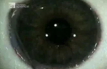 Nacinanie oka, czyli jak wygląda laserowa korekcja wzroku