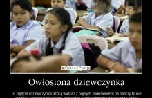 Dziewczynka z owłosieniem na twarzy