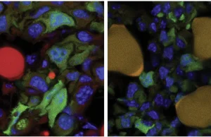 Komórki rakowe stały się tłuszczem! Fascynujące osiągnięcie naukowców